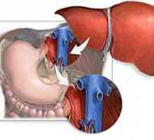 Transplantacija jetre