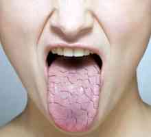 U jutarnjim satima, suha usta: uzroci, posljedice i liječenje