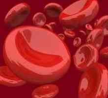 Zašto je visoka hemoglobina kod žena, i šta to znači
