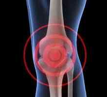 Zašto krcka koljena? Najčešći uzroci