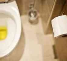Zašto urin je žute boje?