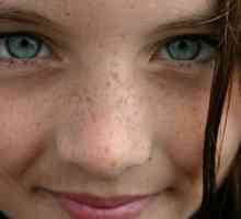 Zašto lice pojaviti tamne mrlje: najvjerovatniji uzroci