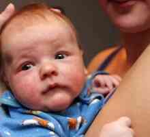 Zašto novorođenče fester oči?