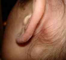 Zašto uvećani limfni čvor iza uha