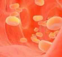 Detalji o tome kako smanjiti holesterol narodne lekove