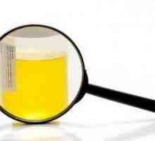 Pojavio oksalata u urinu djeteta: uzroci, simptomi, liječenje