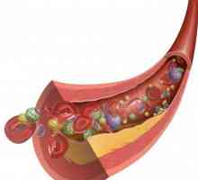 Zdrave namirnice koje smanjuju holesterol u krvi