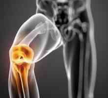 Posljedice povrede koljena. Protetika i rehabilitacija
