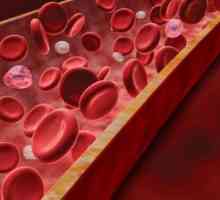 Povećana proteina u krvi: razloge. Biohemijske analize krvi. ukupnih proteina