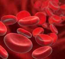 Povećana glukoze u krvi: šta to znači, izaziva, simptomi i karakteristike tretman