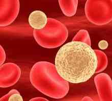 Povišen krvni limfociti u djece: Što trebate znati?