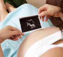 Povećana ton maternice: Uzroci