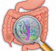 Pripreme za normalizaciju crijevne mikroflore: popis i opis droga