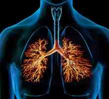 Uzroci i simptomi bronhitisa u djece