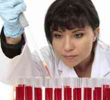 Razlozi za povećanu ESR u krvi žena, dijagnoza, liječenje