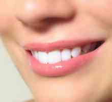 Izbjeljivanje zuba postupak: komentari i preporuke