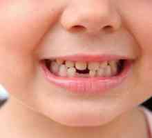 Erupcija i rast zuba u djece: sto. Sve erupcije mliječnih zuba kod beba