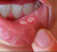 Plikovi na usnama: uzroci i tretman