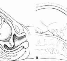 Cervikalna dilatacija 2 prsta kad porođaju? Simptomi cervikalna dilatacija