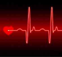 Dešifrovanje EKG srca