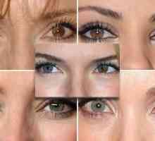 Različite ljudske oči - šta to znači?