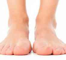 Rossolimo je znak - patoloških refleksa, očituje u fleksiji prstiju stopala ili četke