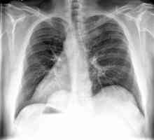 Radiografiju - metoda istrage o unutarnjem uređenju objekata pomoću X-zraka. Mišljenja,…