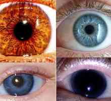 Najrjeđih boja očiju - što je to?