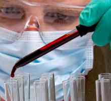 Serološke testove krvi u dijagnostici bolesti