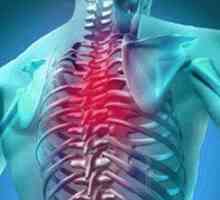 Cervikalne-torakalni osteohondroze: simptomi i droga tretman