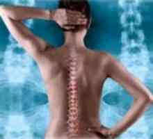 Cervikalni osteohondroza - gimnastiku i tretman