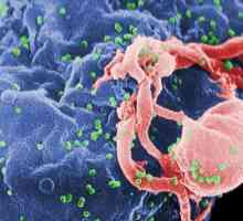 Simptom AIDS-a: kako se bolest manifestuje?