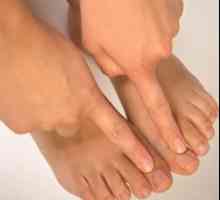 Simptomi noktiju gljiva na noge, i karakteristike sorte