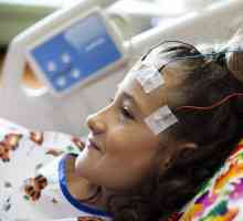 Simptome epilepsije kod djece. Uzroci, dijagnoza, liječenje