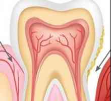 Simptomi parodontopatije, dijagnostici i liječenju