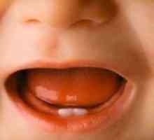 Simptomi reznih zuba u djece: da li roditelji iskustva?