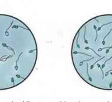 Sperme "in vitro" - preciznost garancija