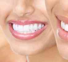 Dental profilaksa za prevenciju bolesti zuba i desni