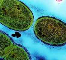 Streptococcus - što je to? vrste streptokoka