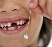Da li je to strah od promene zuba djeteta kao roditelji misle?