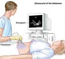 Transabdominalnom ultrazvuk - šta je ovo? Transabdominalnom ginekološki ultrazvuk