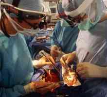 Transplantacija organa i tkiva. Transplantacija organa u Rusiji