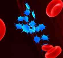 Trombocitopenija - što je to? Uzroci i simptomi