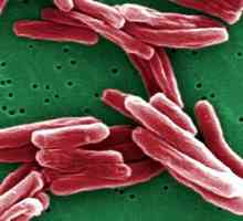 Plućne tuberkuloze distribuirani: Simptomi i tretman