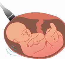 Ultrazvuk skrining studija. Screening test u trudnoći