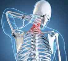 Unkovertebralny osteoartritis vratne kralježnice: uzroci i liječenje