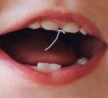 Bridle gornje usne: pravilo liječenje povreda
