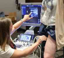 Doppler ultrazvuk donjih ekstremiteta: taktika studija. Indikacije za postupak