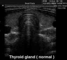 Ultrazvuk štitne žlijezde - norma. Dimenzije štitne žlijezde - norma. Indikatori tiroidnih hormona…