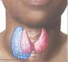 Nodularnog gušavost štitne žlijezde: uzroci, simptomi i tretmani